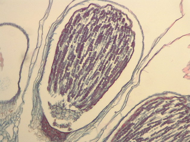 Liverwort Sporophyte Slides - Liverwort Sporophyte 01 100X